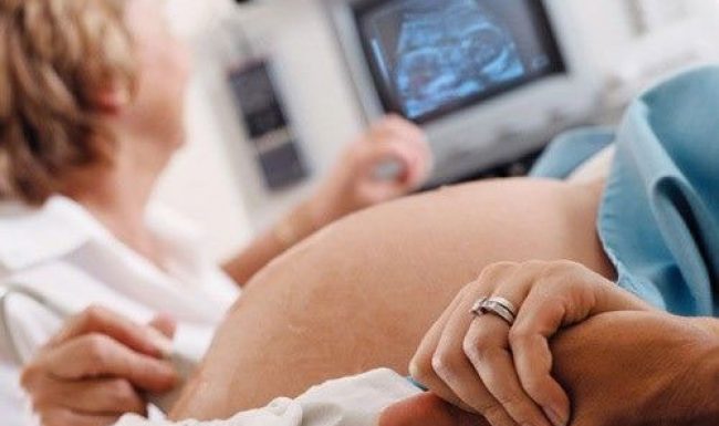 Cách phát hiện thai nhi bị bệnh down sớm từ trong bụng mẹ